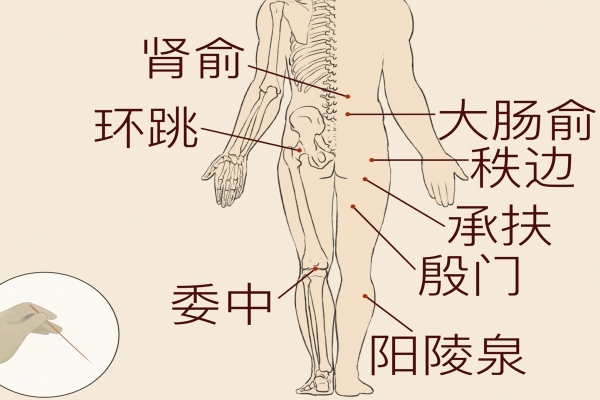 针灸竟有如此神奇的效果